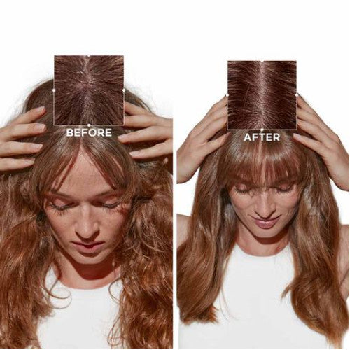 Kerastase Symbiose: Shampoo Purificante Anti-Forfora & Balsamo Lenitivo per Cute Sensibile