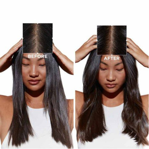 Kérastase Symbiose Kit Shampoo, Balsamo e Siero Anti-Forfora